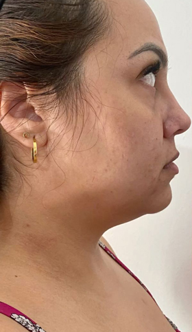 Mulher com brinco e cabelo solto.